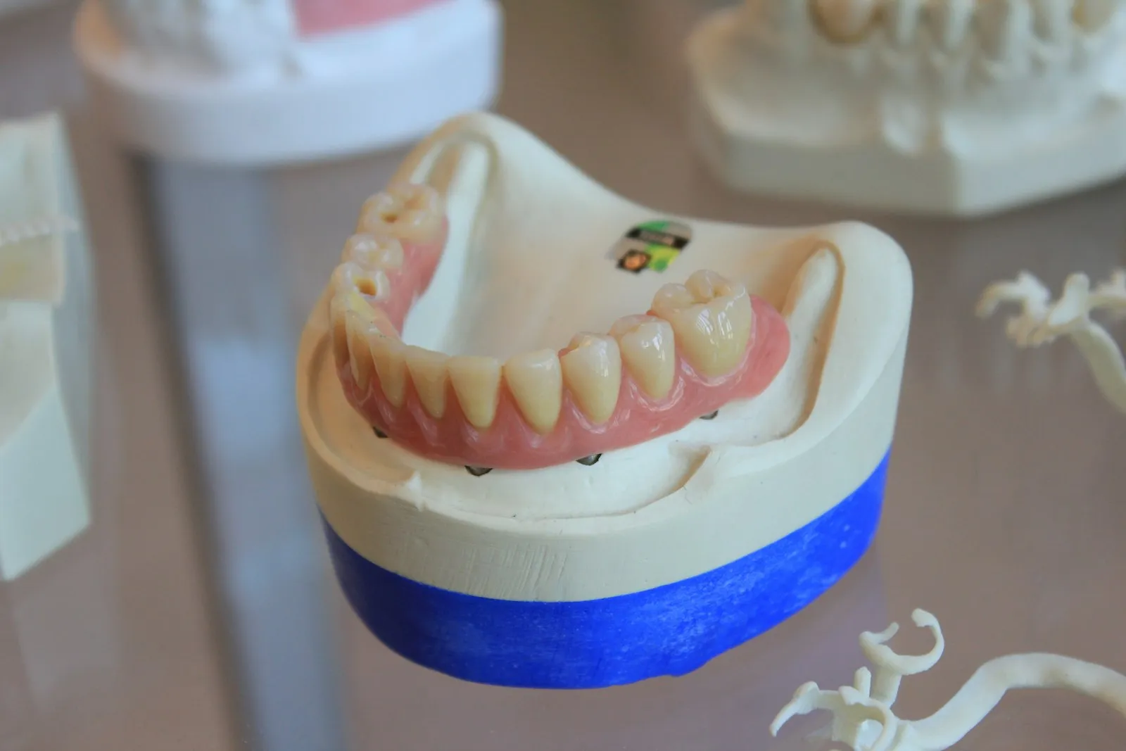 Rack of finished dental prostheses in a dental laboratory
